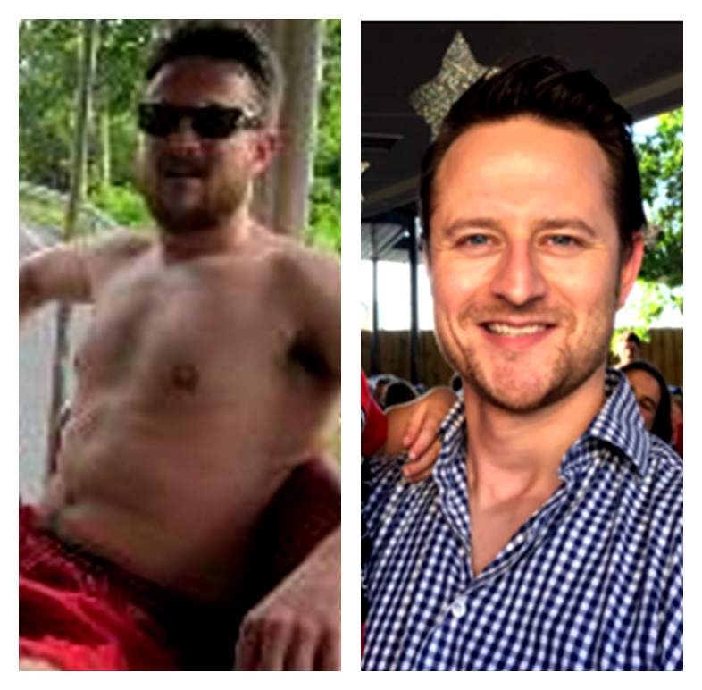 Tom - Before & After